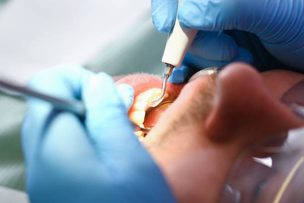 Best Emergency Gum Pain Relief  in Cherryvale, KS