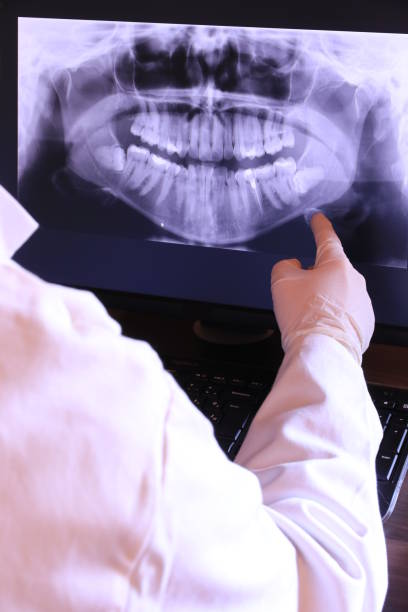 Emergency Dental Filling Replacement in KS